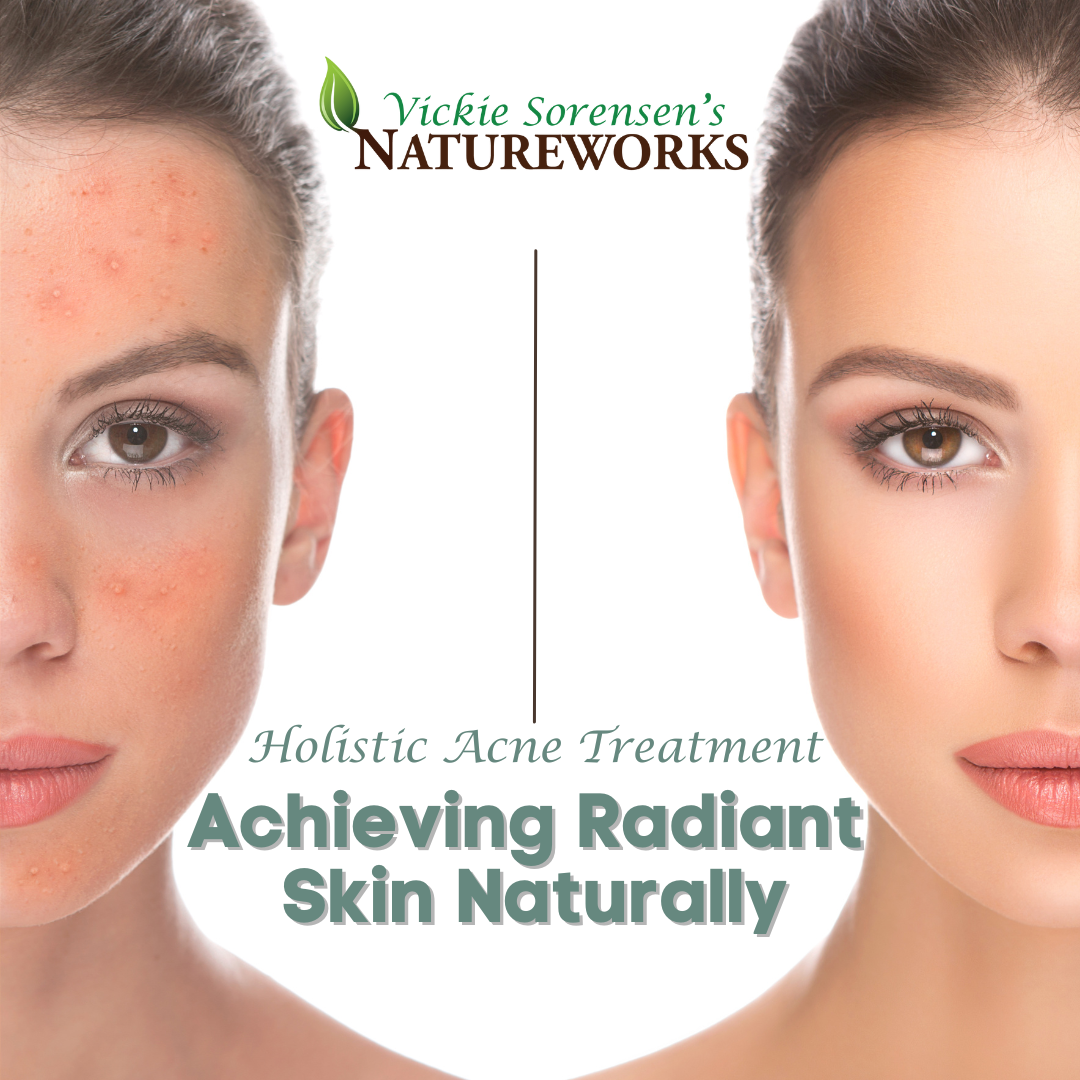 Achieving Radiant Skin Naturally: Holistic Acne Treatment