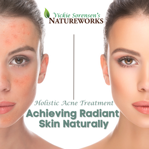 Achieving Radiant Skin Naturally: Holistic Acne Treatment