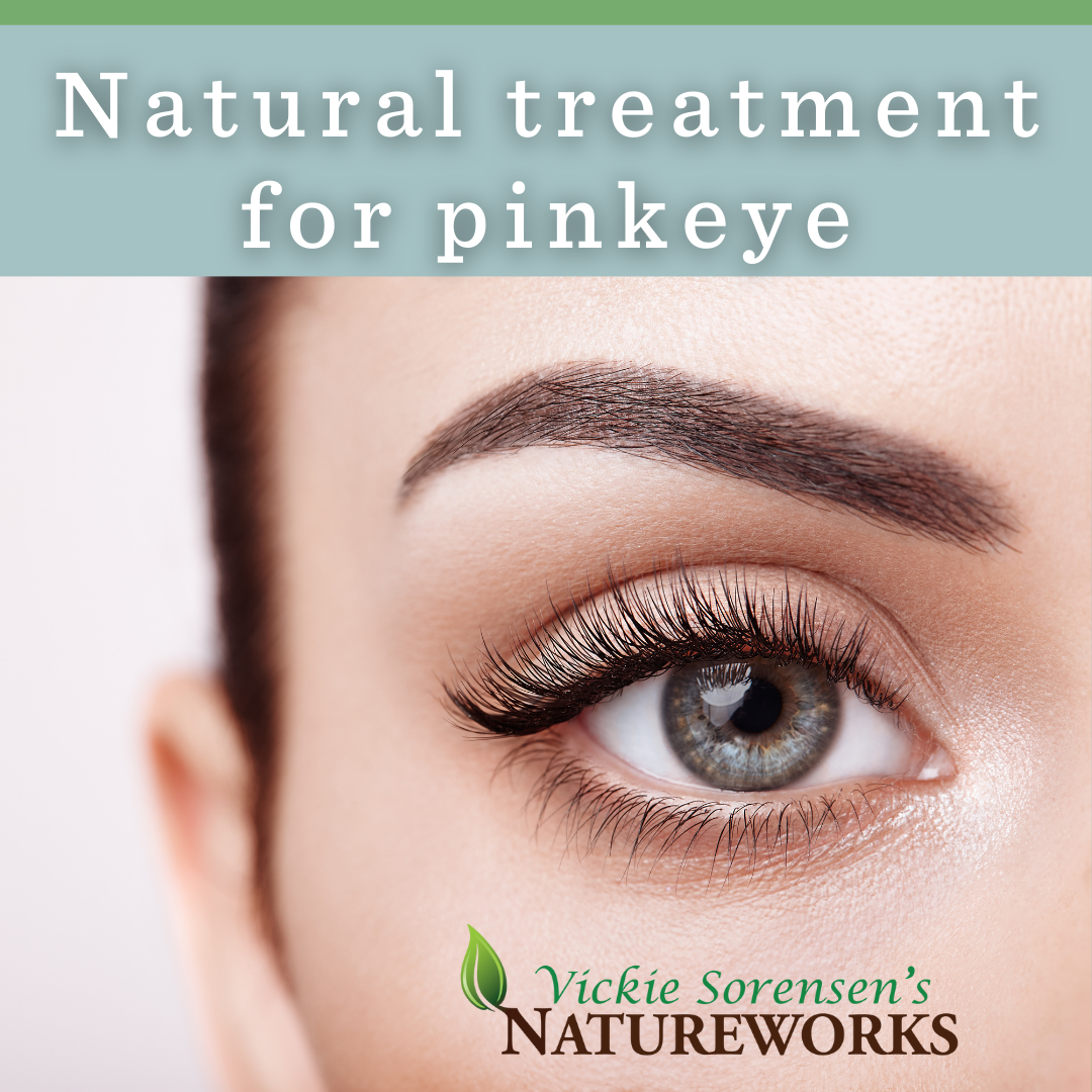 Natural treatment for pinkeye